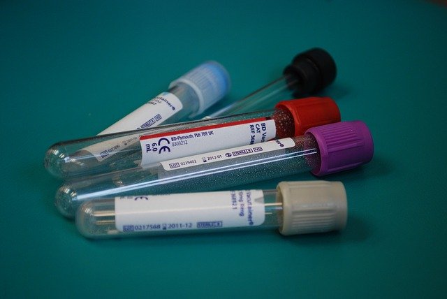 Test tubes for blood testing